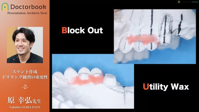 ステント作成 ドリリング練習の重要性 #2