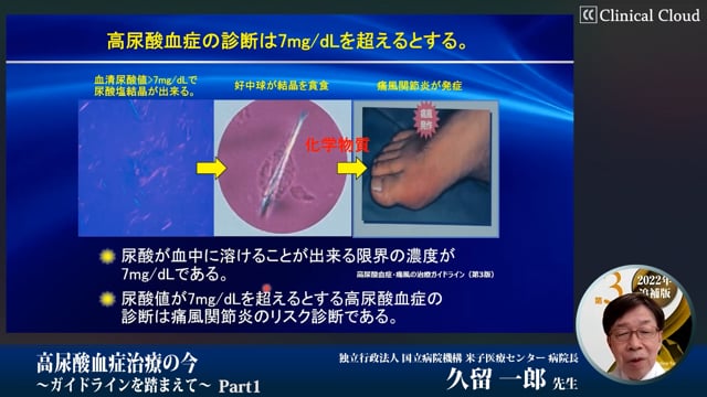 高尿酸血症治療の今～ガイドラインを踏まえて～　Part1
