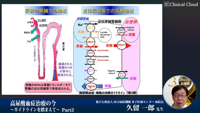 高尿酸血症治療の今～ガイドラインを踏まえて～　Part2