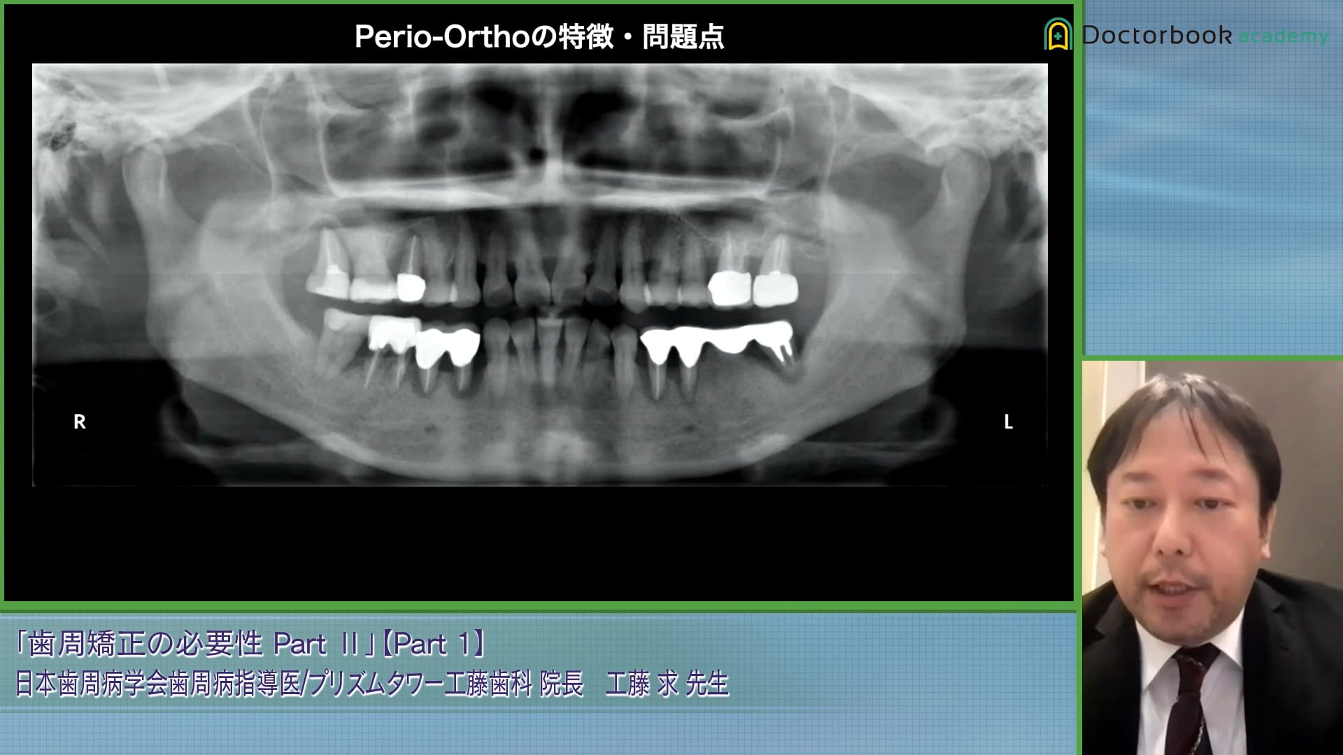 ペリオオルソの問題点と特徴とは？専門医との連携の難易度についても解説 #1