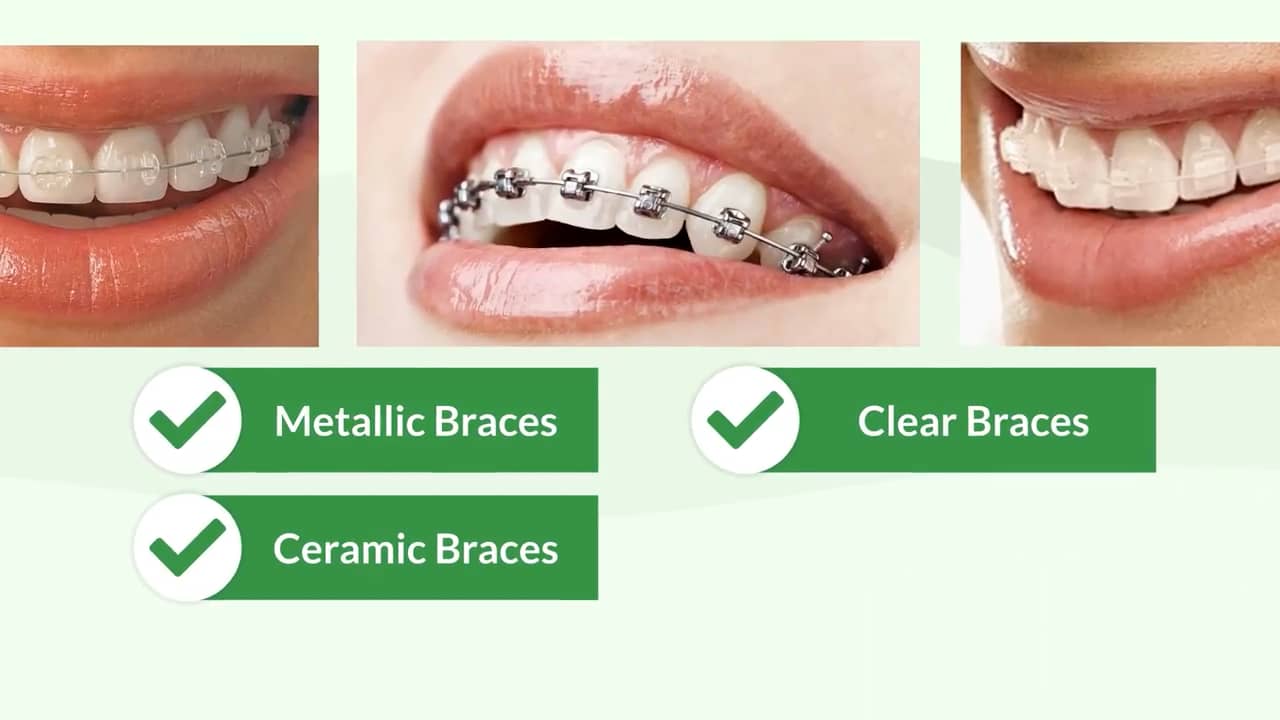 Orthodontic clinic animation video on Vimeo