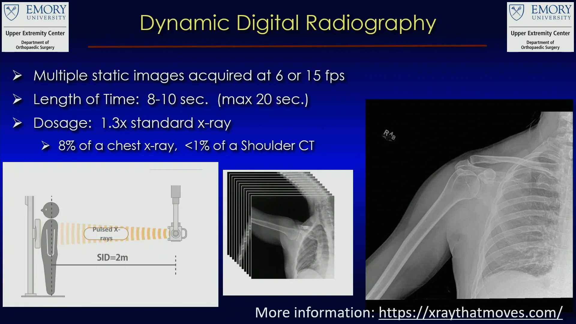 Dynamic Digital Radiography- The Future of Diagnosis in Upper Extremity ...