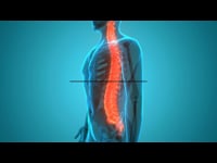 Sports First Aid : Spinal Recovery Position