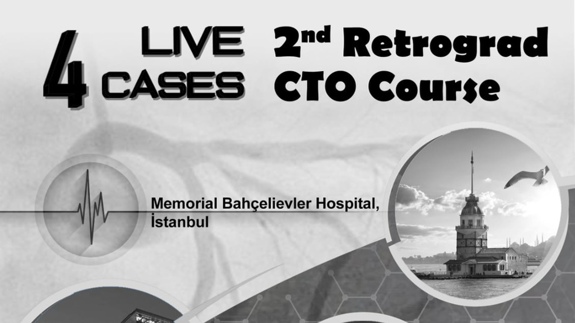 2. Retrograd CTO Course - 9 September 2022