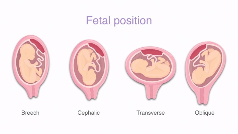 How to assess the fetal position