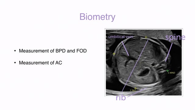 What structures need to be measured to estimate the size of a fetus?