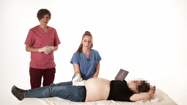 Fetal biometry scan 