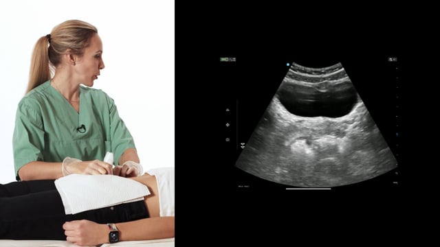 How to scan the uterus and its surrounding structures