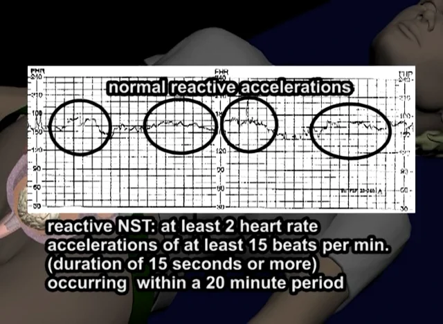 Normal vs. Abnormal Fetal Heart Rate