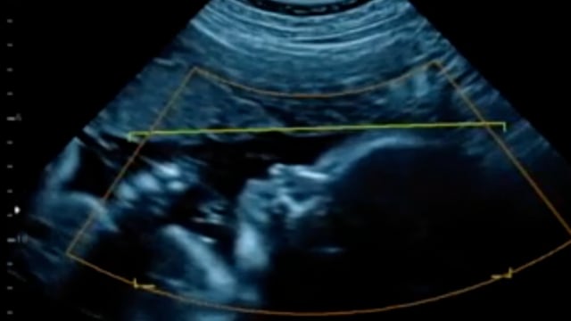Maternity Videos, Download The BEST Free 4k Stock Video Footage