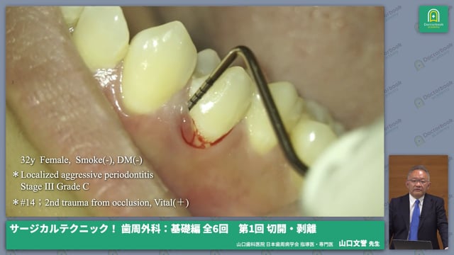 サージカルテクニック！ 歯周外科：基礎編 第1回 切開・剥離