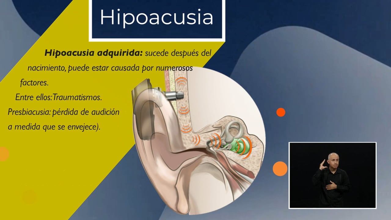 Hipoacusia