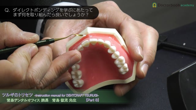 前歯ダイレクトボンディング デモンストレーション(前歯切縁の透明感を出す方法) #8