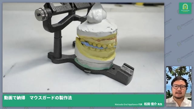 動画で納得　マウスガードの製作法