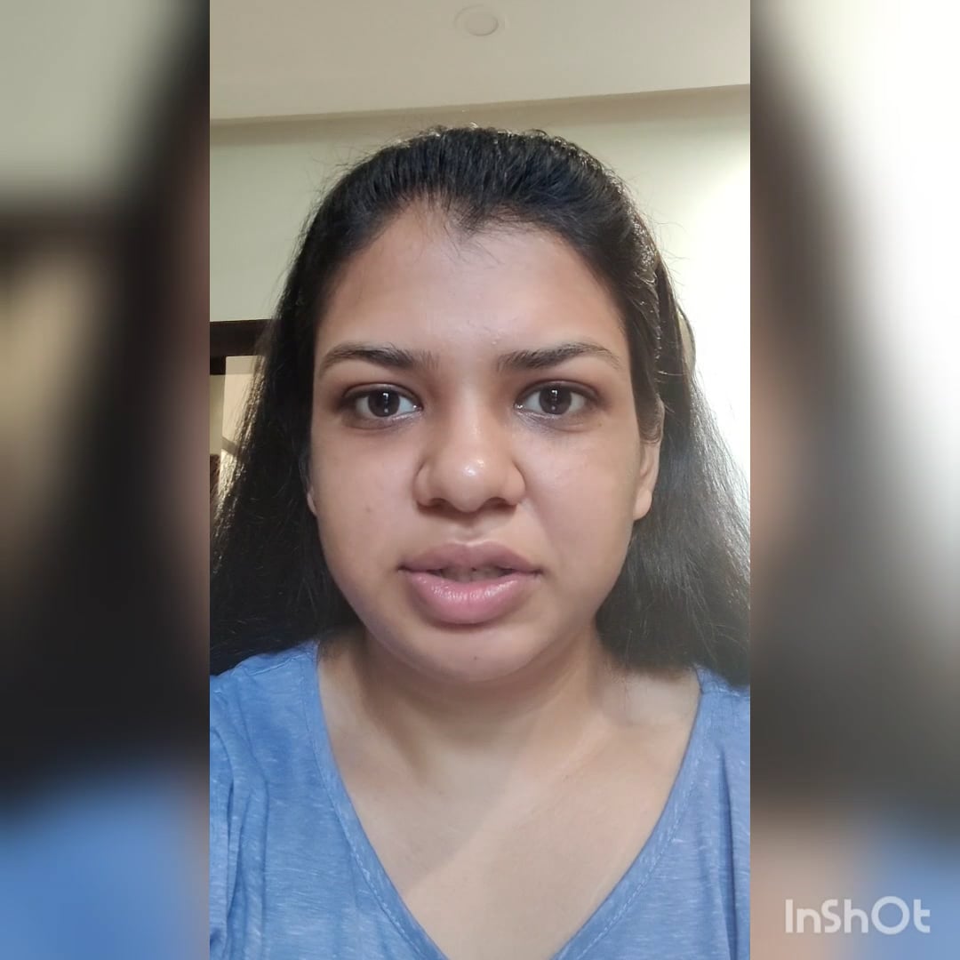 Interview questions on vimeo