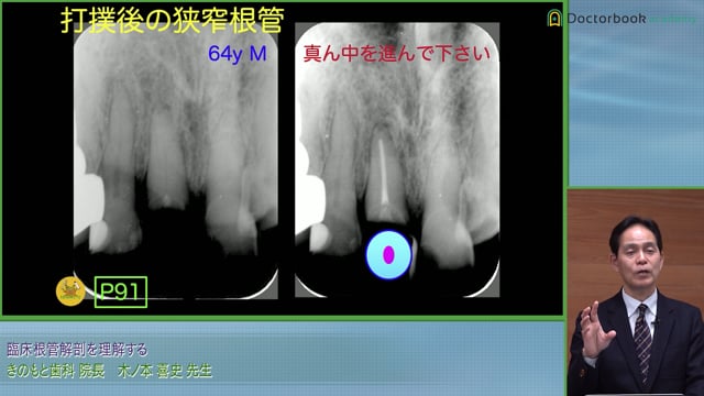 臨床根管解剖を理解する | Doctorbook academy (ドクターブックアカデミー)