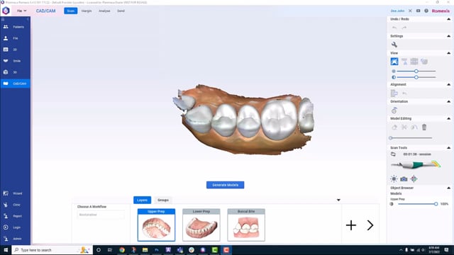 Planmeca Romexis CAD/CAM module on Vimeo