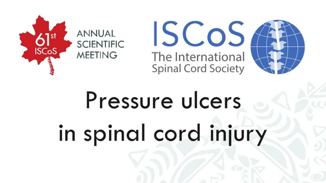 How to Prevent Pressure Sores After a Spinal Cord Injury