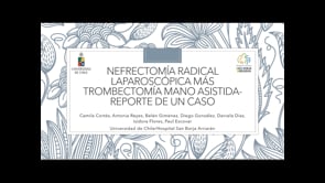 NEFRECTOMÍA RADICAL LAPAROSCÓPICA MÁS TROMBECTOMÍA MANO-ASISTIDA: REPORTE DE UN CASO
