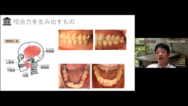 高齢者の義歯治療 咬合力の重要性│荻野洋一郎先生 #1