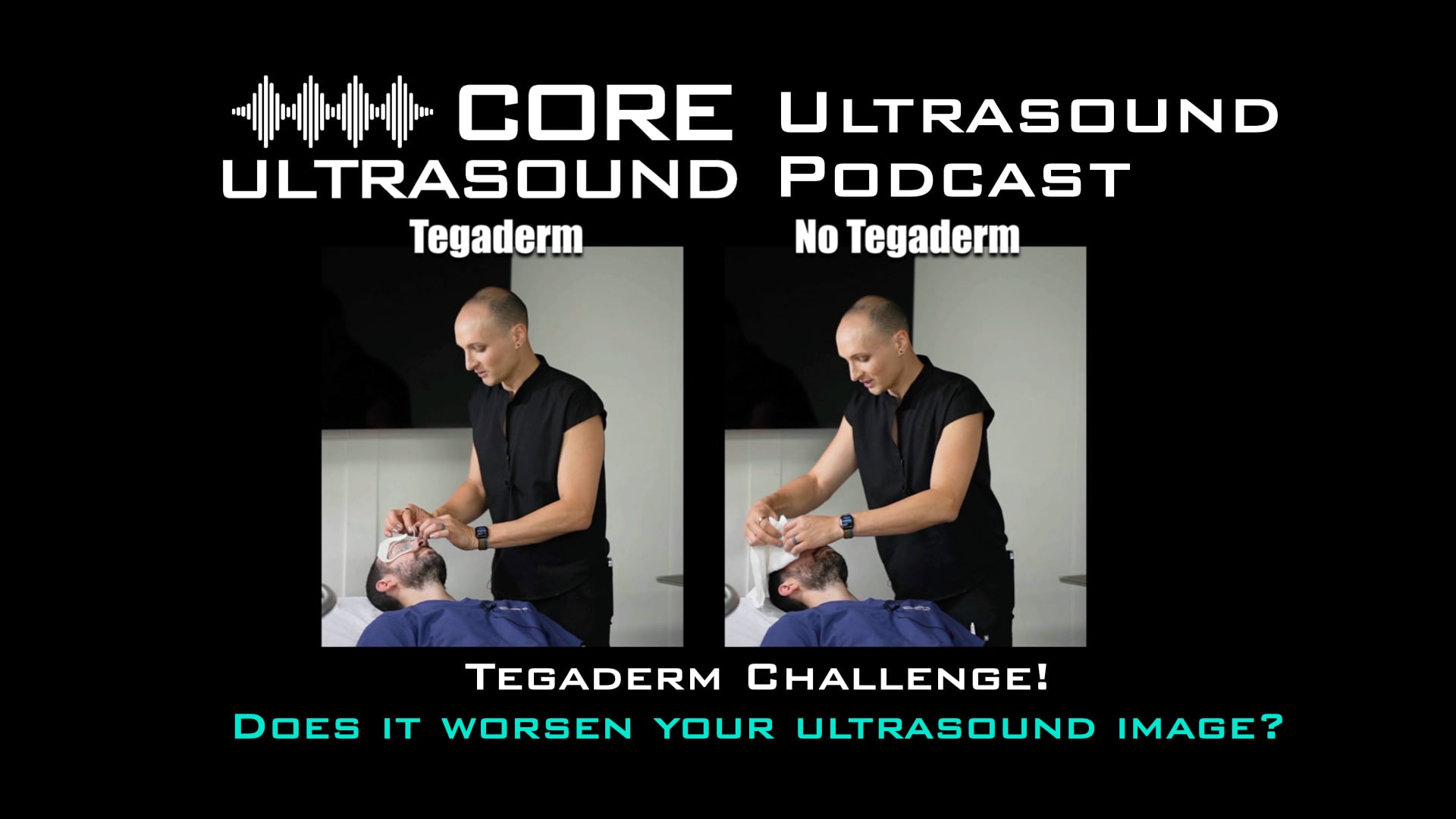Image of Ocular Tegaderm Challenge!