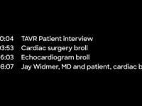 Newswise:Video Embedded baylor-scott-white-medical-center-temple-recognized-for-high-quality-cardiac-surgery-reaching-new-milestones