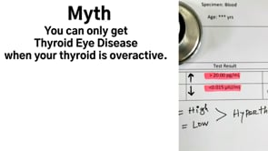 Thyroid Eye Disease Myth (1)