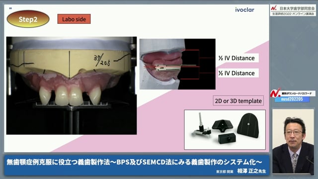 BPSの流れとテクニック #2