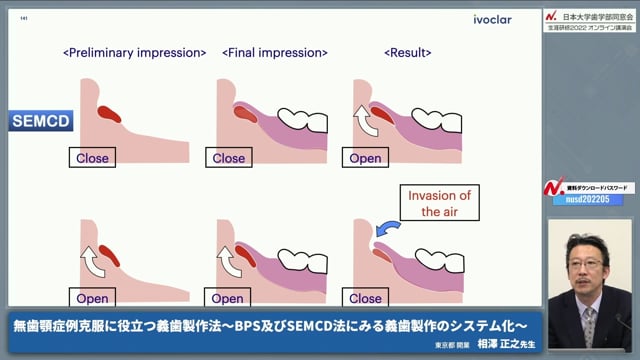 SEMCDの流れとテクニック #3