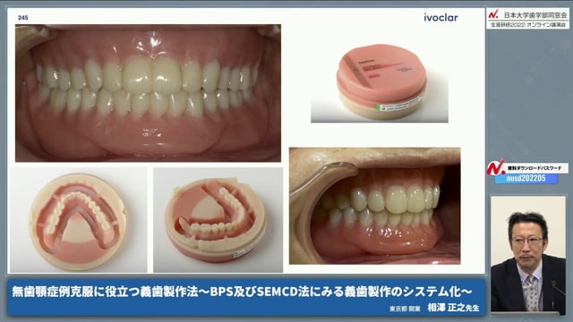 無歯顎症例克服に役立つ義歯製作法～BPS及びSEMCD法にみる義歯製作の 