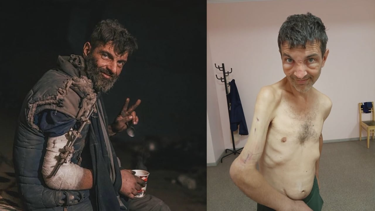 War in Ukraine: EXCLUSIVE – Azovstal prisoner of war reveals torture at hands of Russians (1 October 2022)