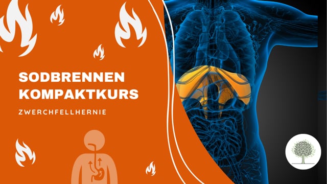 Zwerchfellhernie (diaphragmale Hernie) als Ursache für Sodbrennen? 