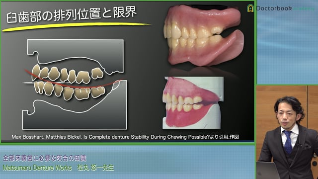 Gerber Theoryと義歯の咬合について #1