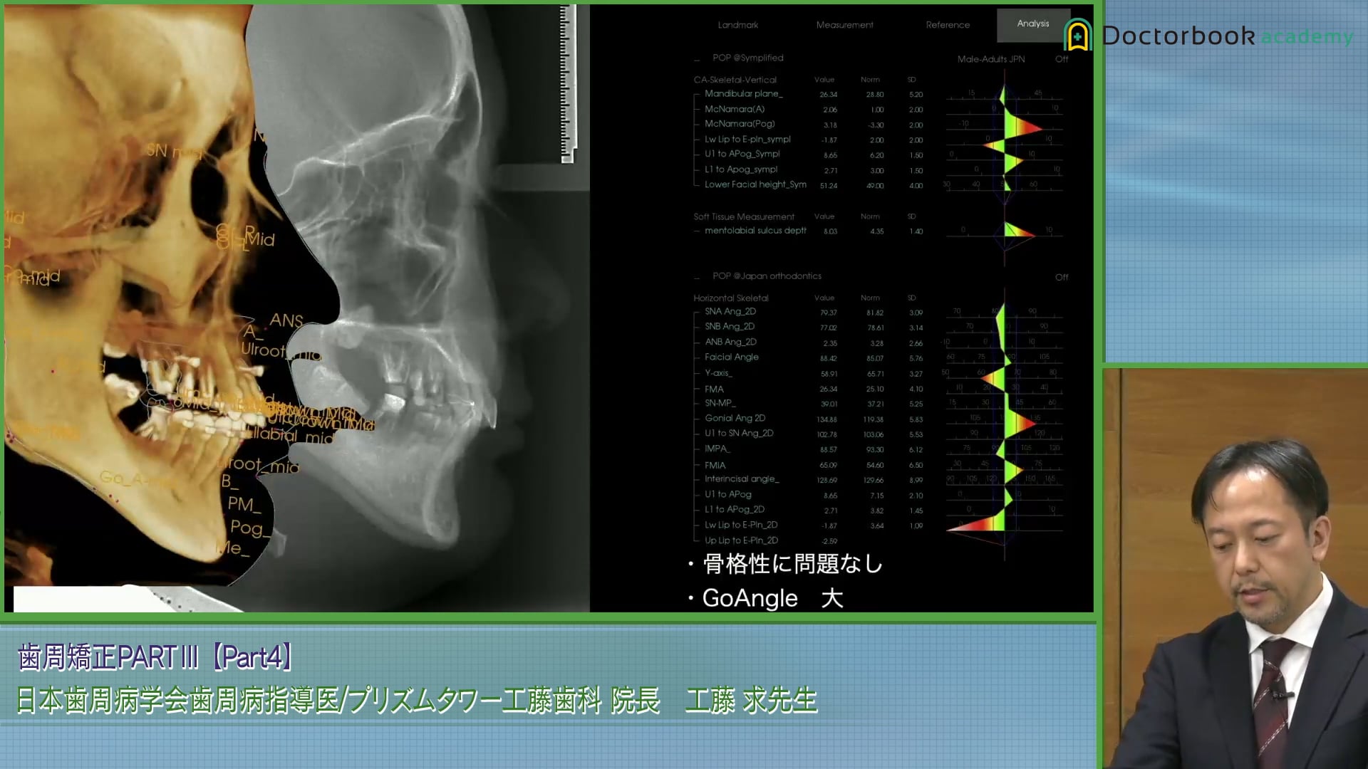 費用を抑えながら歯周炎と見た目・機能的回復が求められる治療法とは #4