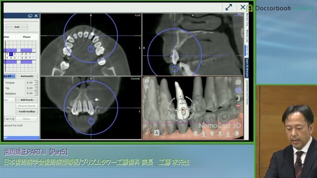 ブラケット矯正後の後戻りと病的な歯の移動｜動画で分かりやすく解説 #5