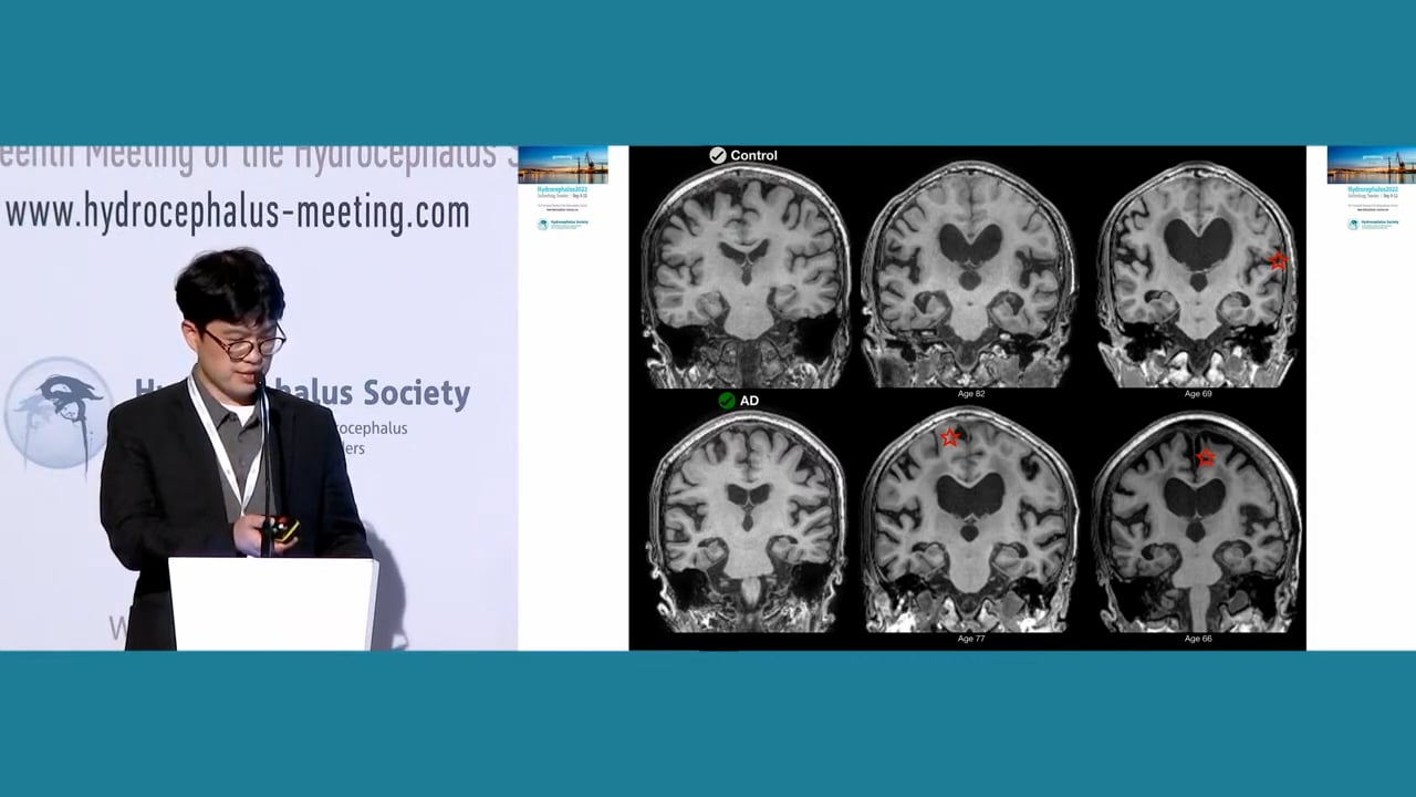S11. Kyunghun Kang - DISTINCT VOLUMETRIC FEATURES OF CEREBROSPINAL FLUID DISTRIBUTION IN IDIOPATHIC NORMAL-PRESSURE HYDROCEPHALUS AND ALZHEIMER’S DISEASE
