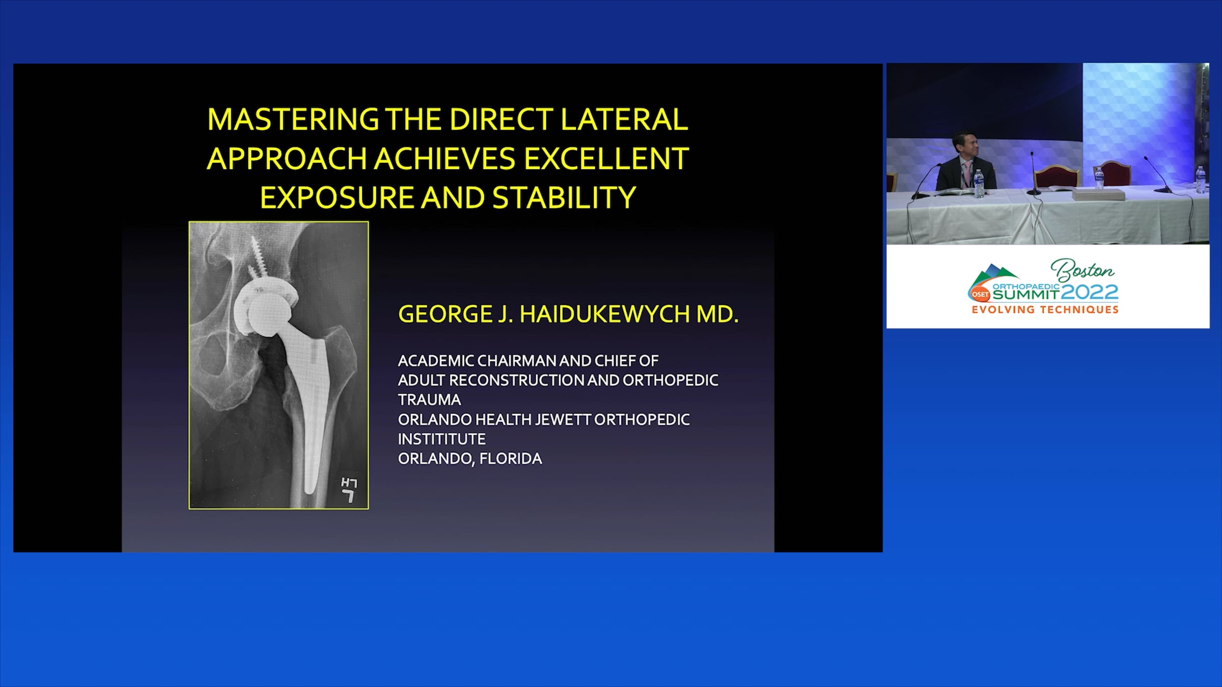 Mastering The Direct Lateral Approach George J. Haidukewych, MD ...