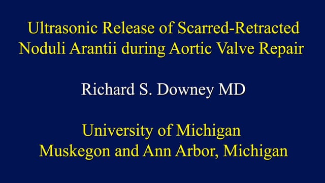 Ultrasonic Release of Scarred-Retracted Noduli Arantii During Aortic Valve Repair