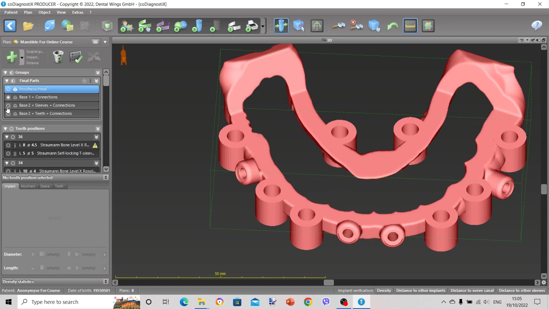 Watch Making Stackable Guides WIth CoDiagnostix Online Vimeo