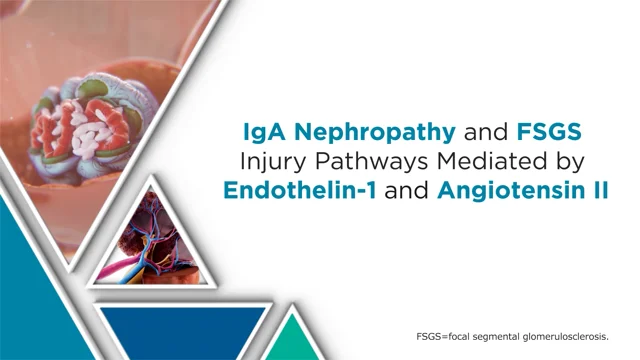 Focal Segmental Glomerulosclerosis