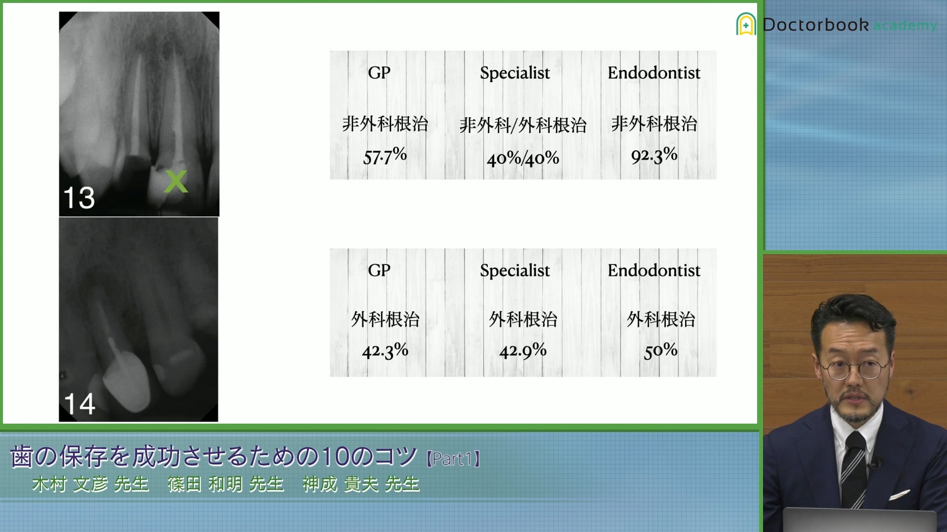 歯を保存するための10のコツを3つの視点から考える│木村 文彦先生 #1