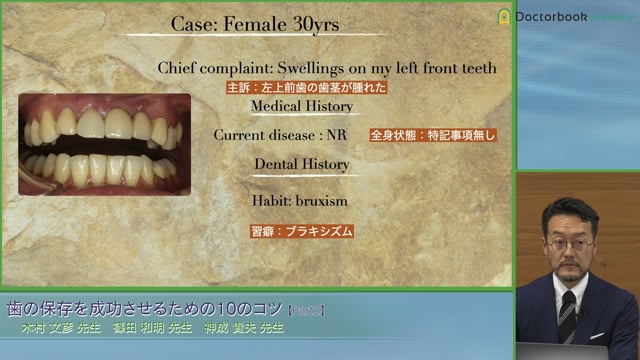 歯の保存と歯肉炎・歯周病、意図的再植症例│木村 文彦先生 #2