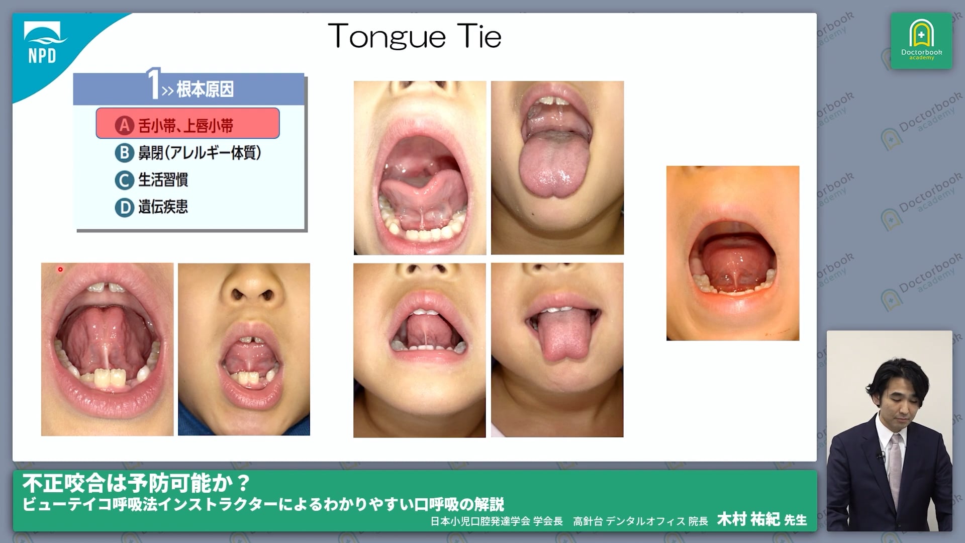 口呼吸とは何か？口呼吸の根本原因 #2