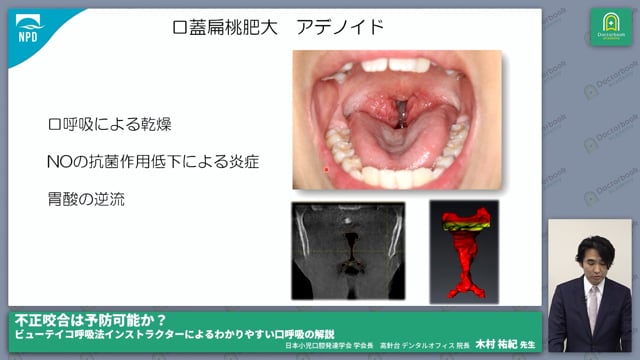 口呼吸の危険性と呼吸再訓練法 #4