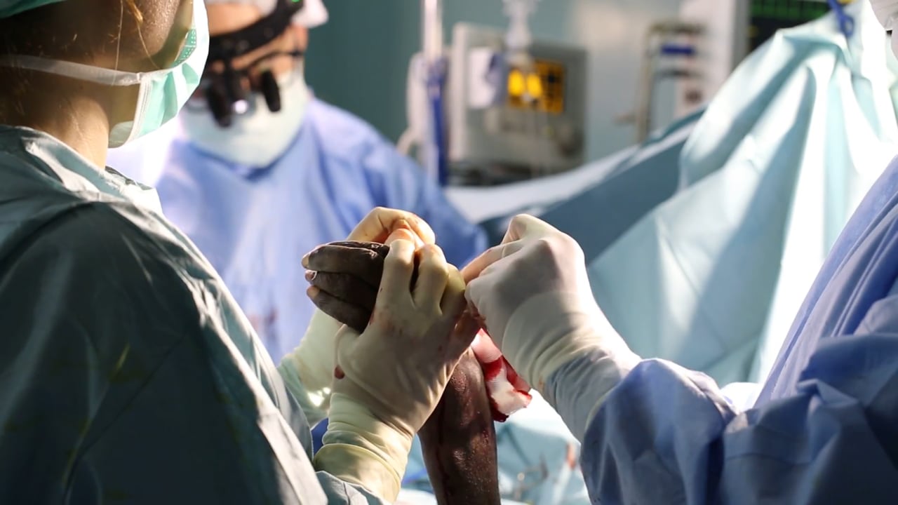 Live Hand Surgery During Medical Mission to Rural Ghana
