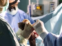 Cirugía de manos en directo durante una misión médica en una zona rural de Ghana