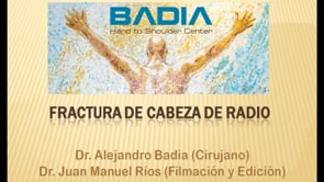 Fixation of Intra-articular Fracture of the Radial Head – Manson II Radius Head Fracture