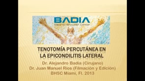 Tenex FAST Tenotomía Percutánea Epicondilits Lateral – Dr. Badia Cirujano de Mano