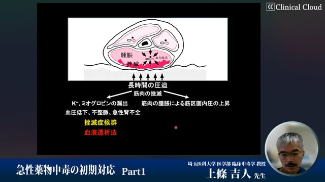 急性薬物中毒の初期対応　Part1