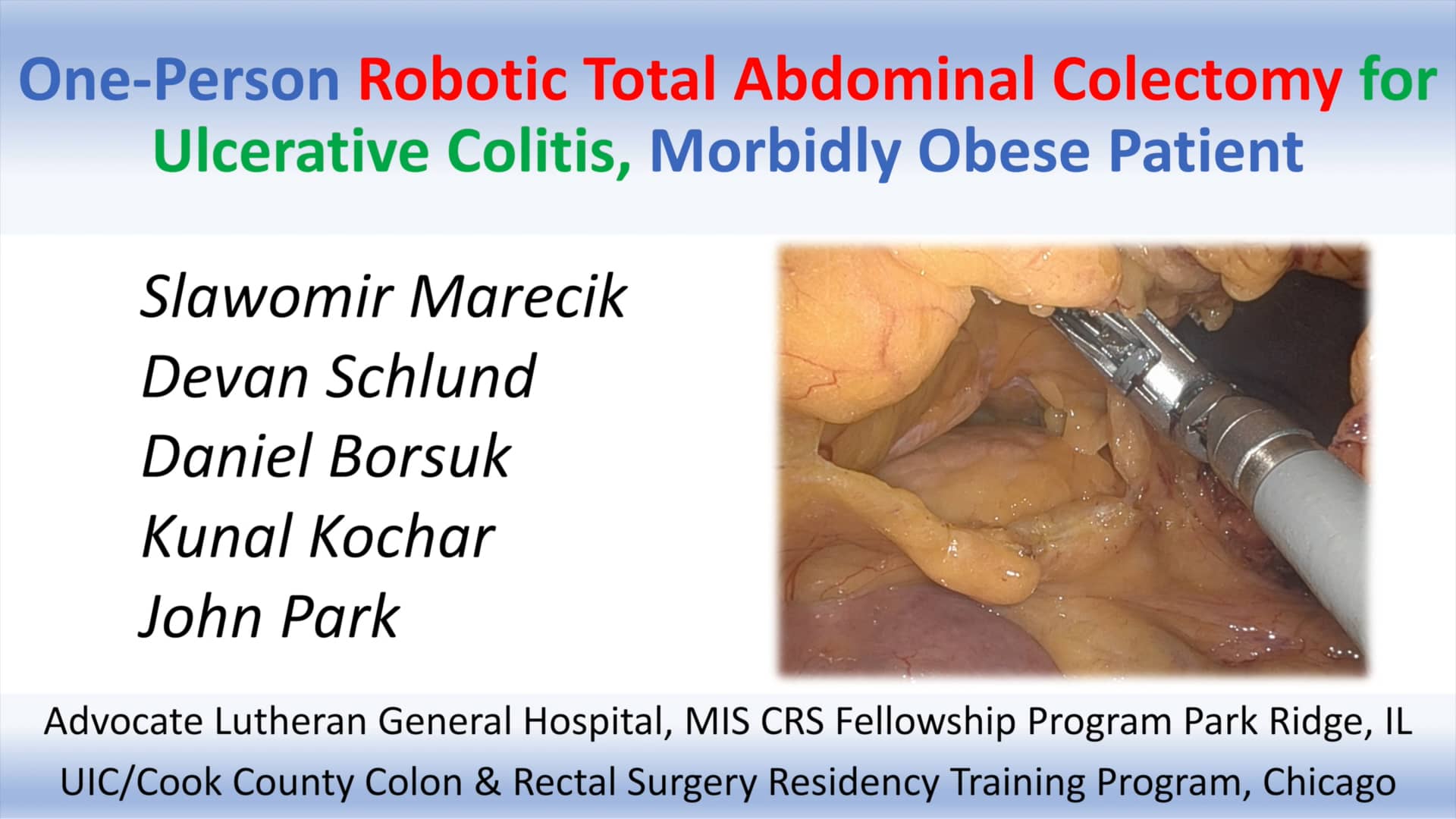 OnePerson Robotic Total Abdominal Colectomy for UC, Morbidly Obese on Vimeo